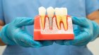 Ölü heyvan və insan sümüyündən hazırlanan diş implantları &ndash; Yeni sahibinin şəxsiyyətini dəyişə bilərmi?