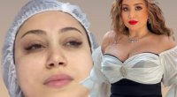 Damla 9 saatlıq plastik əməliyyatından DANIŞDI: “Sinə ölçümü və ...” - VİDEO 