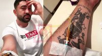 Vüqar xəstəxanalıq oldu: 