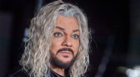 3 milyonluq plastik əməliyyatdan sonra Kirkorov ÜZƏ ÇIXDI - FOTO