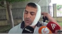 “Bir də gördüm, qulağım yoxdur…” – Qulağını eşşək qopardan kişi danışdı + VİDEO