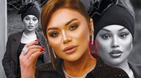 Bu da əməliyyatdan sonra 180 dərəcə dəyişən Türkan Vəlizadə - FOTO
