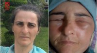 Lənkəranda qonşular arasında dava: Fiziki qüsurlu qadın xəsarət aldı – FOTO