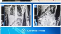 Bakıda 17 yaşlı yeniyetmə taxta UDDU – FOTO