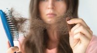 Gənclər arasında saç tökülməsi halları niyə çoxalır? - SƏBƏB