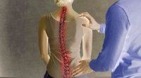 Yeniyetmələrdəki bu problem onurğa əyriliyinə səbəb OLA BİLƏR