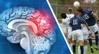Peşəkar futbolçularda beyin həcmi azalır &ndash; YENİ ARAŞDIRMA