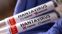Venesuelada hantavirus həyəcanı: Ölənlər var