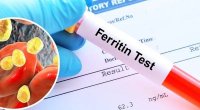 Əksəriyyətin ferritin haqqında bilmədiyi VACİB MƏLUMAT