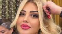 Bakıda qadın dişini çəkdirdiyinə görə vəfat edib? &ndash; Video