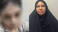 Bacısı oğluna işgəncə verən falçının məhkəməsi: "Hər dəfə uşaq deyirdi ki, pişik cırmaqlayıb"