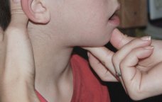 “Çöp” qalma MİFİ – Müasir tibb YOX, xalq ÜSULU?