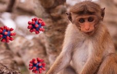 &ldquo;Meymunçiçəyi&rdquo; QAPIDA &ndash; Azərbaycanda bu virusa YOLUXAN var? -RƏSMİ AÇIQLAMA