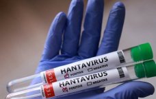 Dünyanı qorxuya salan hantavirus bu şəkildə YAYILIR &ndash; Daha bir XƏBƏRDARLIQ