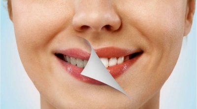 DİQQƏT: Dişlərdəki sarı ləkələr bu xəstəliklərin əlamətidir
