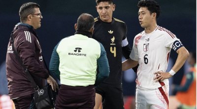 “Fənərbağça”nın yeni transferi ZƏDƏLƏNDİ