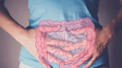 Adı çəkilən məhsullar bağırsaq xərçəngi riskini 17 faiz azaldır