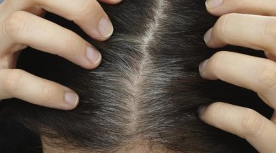 Saçlar niyə vaxtından tez ağarır? - Stresslə əlaqəsi yoxdur