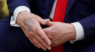 Yenə əlləri ilə gündəm oldu