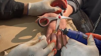 Barmağında sıxışan üzüyü belə çıxardılar &ndash; VİDEO