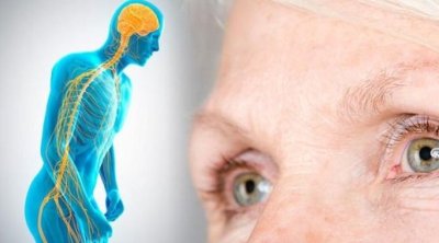 Parkinson xəstəliyi səssiz başlayır &ndash; Həkimdən XƏBƏRDARLIQ