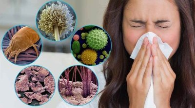 Bu tarixə qədər insanların yarısında allergiya olacaq &ndash; ŞOK XƏBƏRDARLIQ