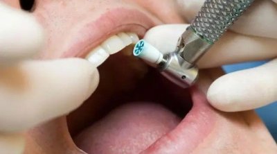 Diş müayinəsi həyatı bahasına başa gəldi: Komaya düşdü, əzalarını itirdi &ndash; FOTO