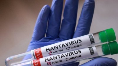 Hantavirusun hansı heyvandan keçdiyi BİLİNDİ – Bu ölkələrdə olur - FOTO
