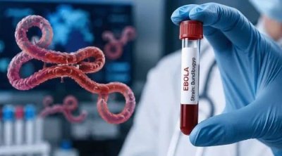 Konqoda yayılan Ebola ştamı artıq sərhədləri AŞIR