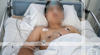 Gürcüstanda dəhşətli hadisə: 15 yaşlı Əli Azərbaycan dilində danışdığı üçün bıçaqlandı – VİDEO