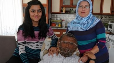 Siqareti tərgitmək üçün başına məftil qəfəs taxdı