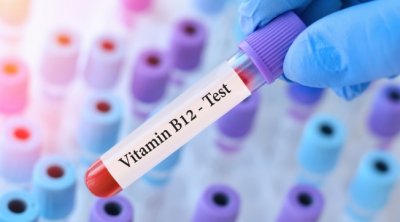 Qanında B12 vitamini yüksək olanlara XƏBƏRDARLIQ
