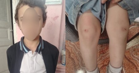 İki şagirdin məktəbin ayaqyolunda mütəmadi döyülməsi ilə bağlı RƏSMİ AÇIQLAMA