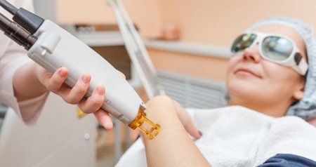 Kosmetoloqlarla dermatoloqlar ÜZ-ÜZƏ - Yayda lazer epilyasiyası olar, ya olmaz?