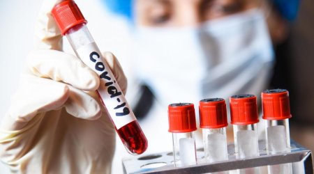 Yoluxma sayı azaldı - STATİSTİKA