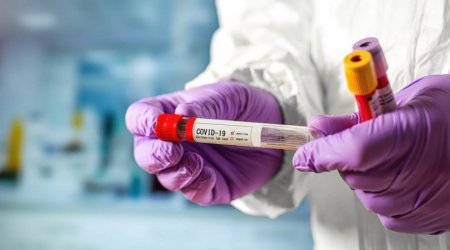 \'\'Kifayət kədər koronavirus testi ehtiyatı var\'\' - Agentlik