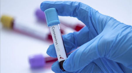 Son sutkada 1101 nəfər yoluxdu, 37 nəfər öldü