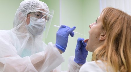 Səhiyyə Nazirliyi test cavablarını gecikdirdiklərini ETİRAF ETDİ 