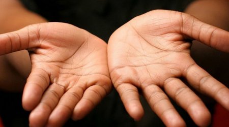 Təzə başlayan şəkərli diabetin xarici ƏLAMƏTLƏRİ
