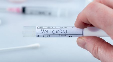 “Omikron”la bağlı inanılmaz NƏTİCƏ – Ağciyərlərdə...