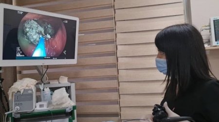 Xurmanı tumları ilə yeyən qadının mədəsi daşlaşdı – FOTO