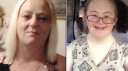 Daun sindromlu qızını ac saxladı – NƏTİCƏSİ…