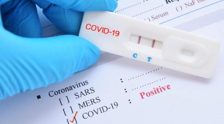 COVID testlərinin nəticələri niyə gecikir? – RƏSMİ CAVAB 