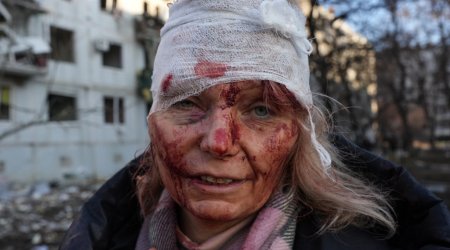 Xarkovda yaralanan müəllimin portreti 100 min dollara satıldı - FOTO