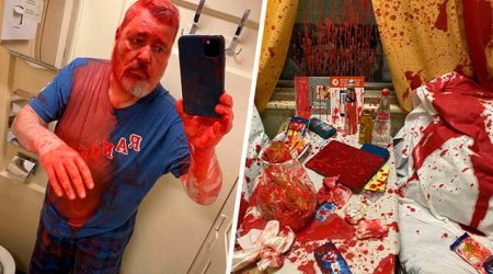 Rusiyalı nobel mükafatçısına qatarda HÜCUM: Üstünə qırmızı boya tökdülər - FOTO