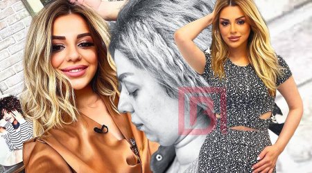 Əminənin plastik əməliyyat etdirdiyi ÜZƏ ÇIXDI - FOTO 