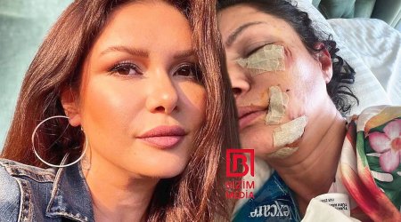 Türkiyəli məşhur aktrisanı it dişlədi, üzü tanınmaz halda - VİDEO  