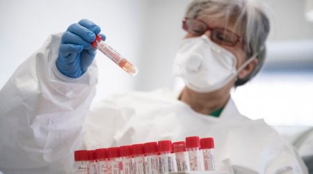 Azərbaycanda daha 266 nəfər koronavirusa yoluxdu - 2 xəstə öldü