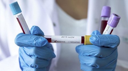 Azərbaycanda son sutkada 161 nəfər COVID-19-a yoluxdu
