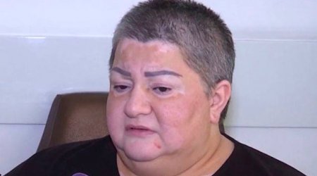 Könül Xasıyevanın əməliyyatı üçün 254 min manat lazımdır - FOTO
